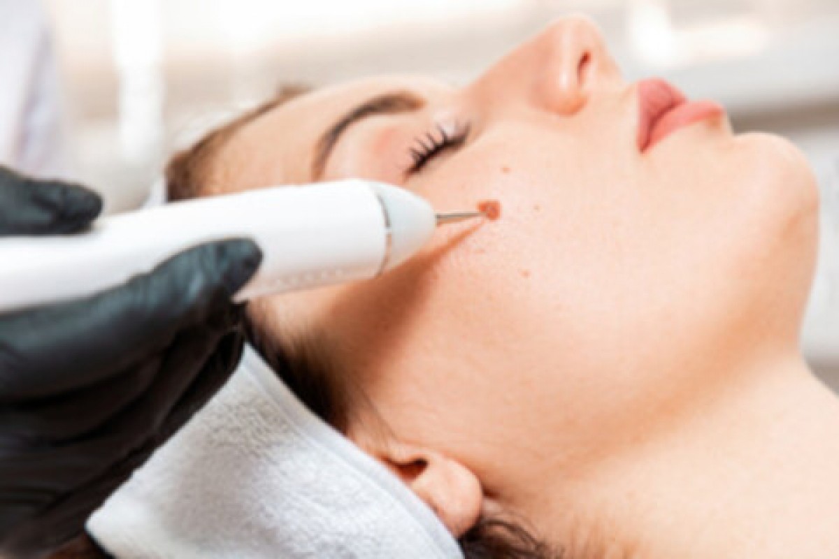 O que deve saber sobre a cirurgia plástica, reconstrutiva e estética
