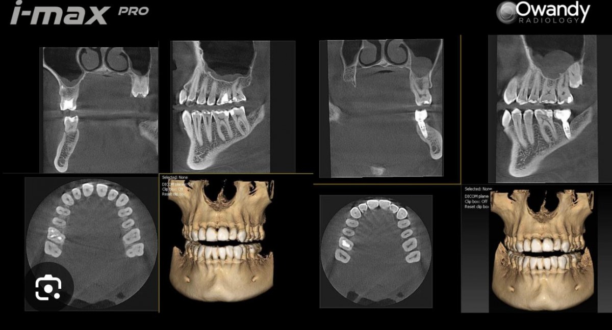 NOVO EQUIPAMENTO DE C.B.C.T., TAC 3D